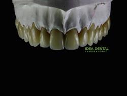 Idea Dental, Huércal de Almería