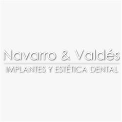 Clínica Dental Navarro Madrid - Dentistas - Implantes dentales