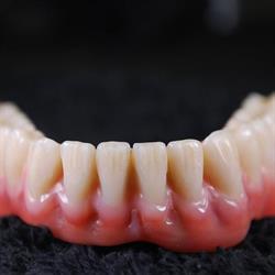 Dental Velay, Vigo