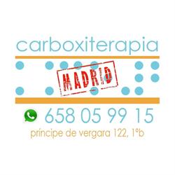 Carboxiterapia Madrid
