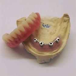 Laboratorio De Protesis Sexitanodental, Almuñecar