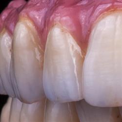 Dental zirconio s.l., Donostia-San Sebastián