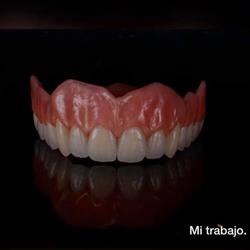 ABM LABORATORIO DENTAL. Alejandra Baldeón Madrid., Novelda