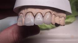 Salvador Piña - Diseño Dental, Narón