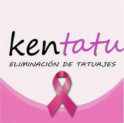 Kentatu, Bilbao