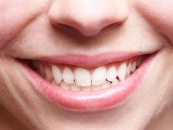 Clínica Michael Robert Blanqueamiento Dental, Cartagena