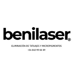 Benilaser® - Eliminación profesional de tatuajes en Benidorm