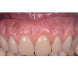 laboratorio protesis dental carlos pujante monteagudo, Murcia